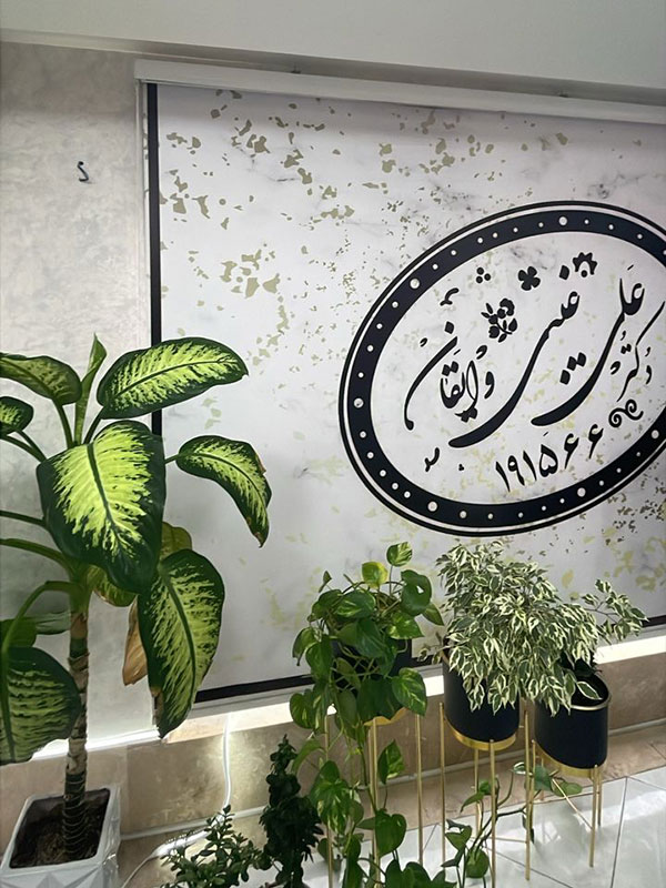 چاپ روی پرده شید