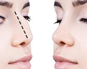 جراحی بینی و سینه محبوبترین عمل ها شدند