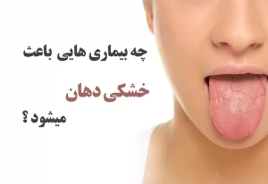 چه بیماری هایی باعث خشکی دهان میشود؟